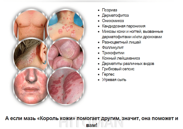 Лечение от стресса препаратами