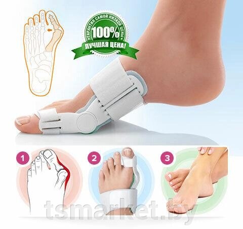 Шарнирная шина от косточки на пальце Hallufix Hallux Valgus. от компании TSmarket - фото 1