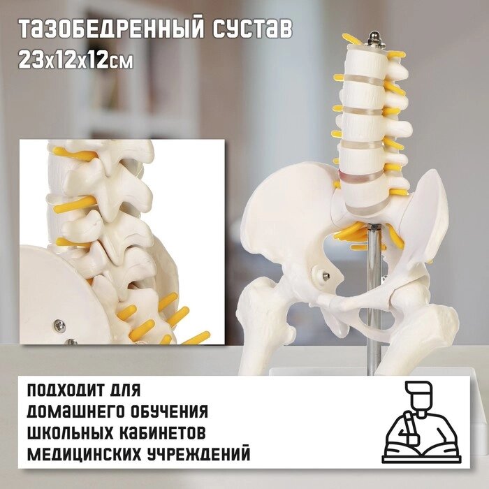 Макет "Поясничный отдел позвоночника, тазобедренный сустав" 23*12*12см от компании Интернет-гипермаркет «MALL24» - фото 1