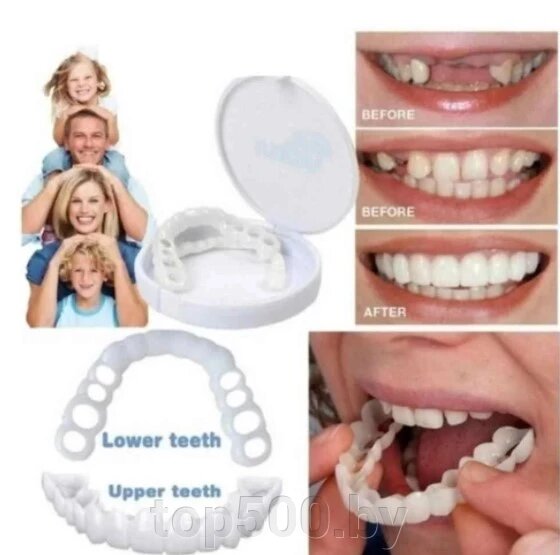 Накладные зубы Snap on Smile (набор для ВЕРХНИХ + для НИЖНИХ зубов) от компании TOP500 - фото 1