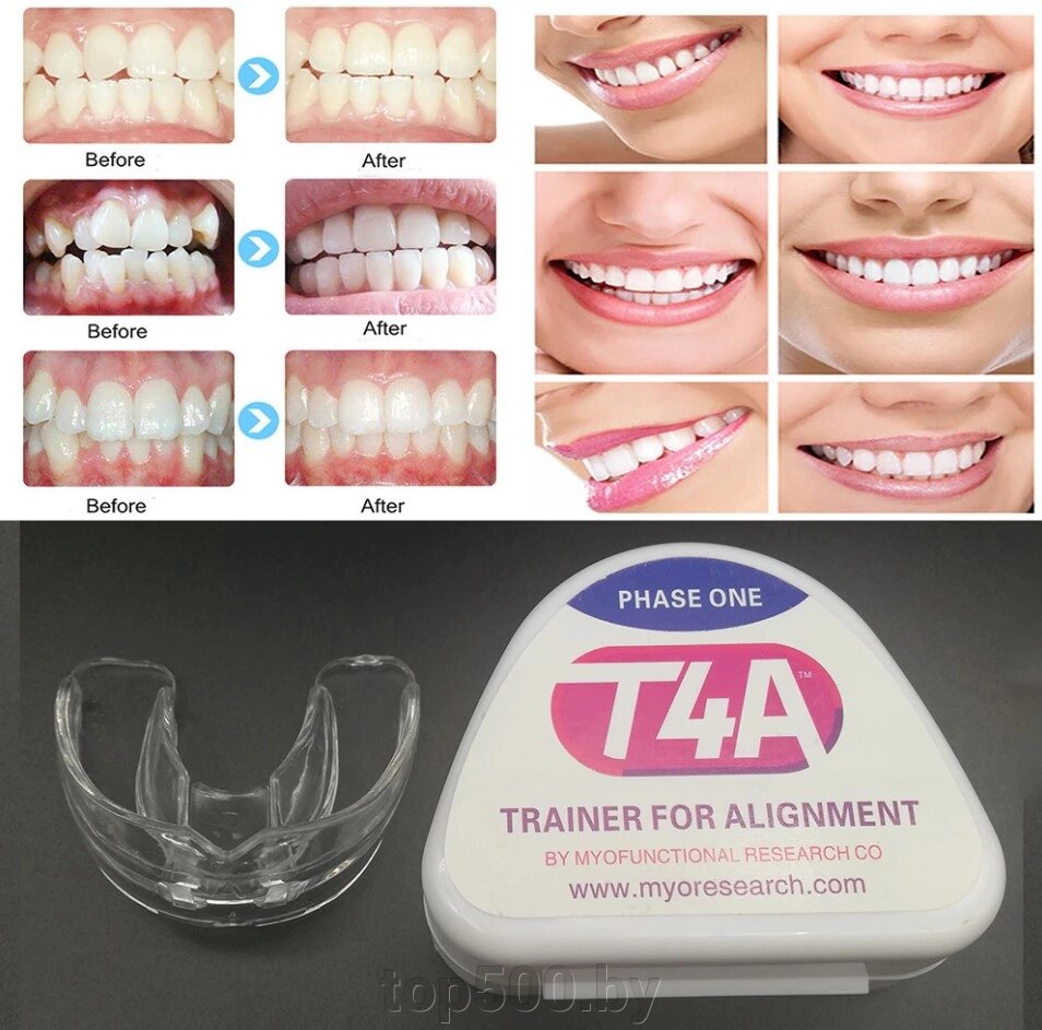 Трейнер Т4A для зубов (капа для исправления прикуса) от компании TOP500 - фото 1