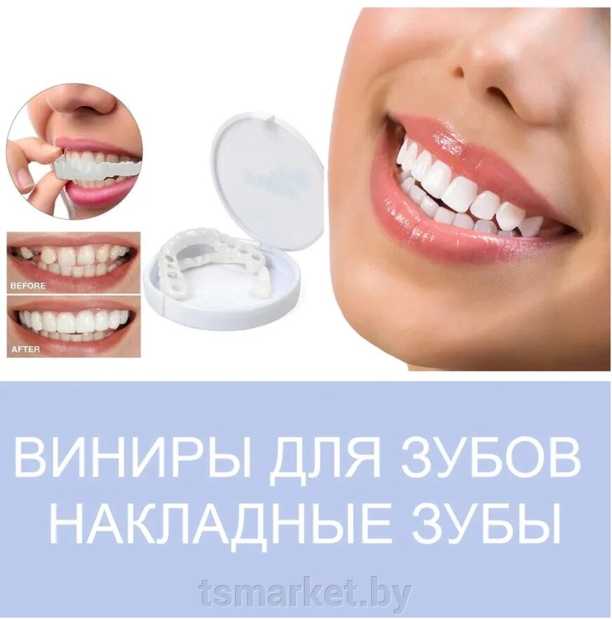 Накладные виниры для зубов Snap-On Smile / Съемные универсальные виниры для ослепительной улыбки 1 шт. от компании TSmarket - фото 1