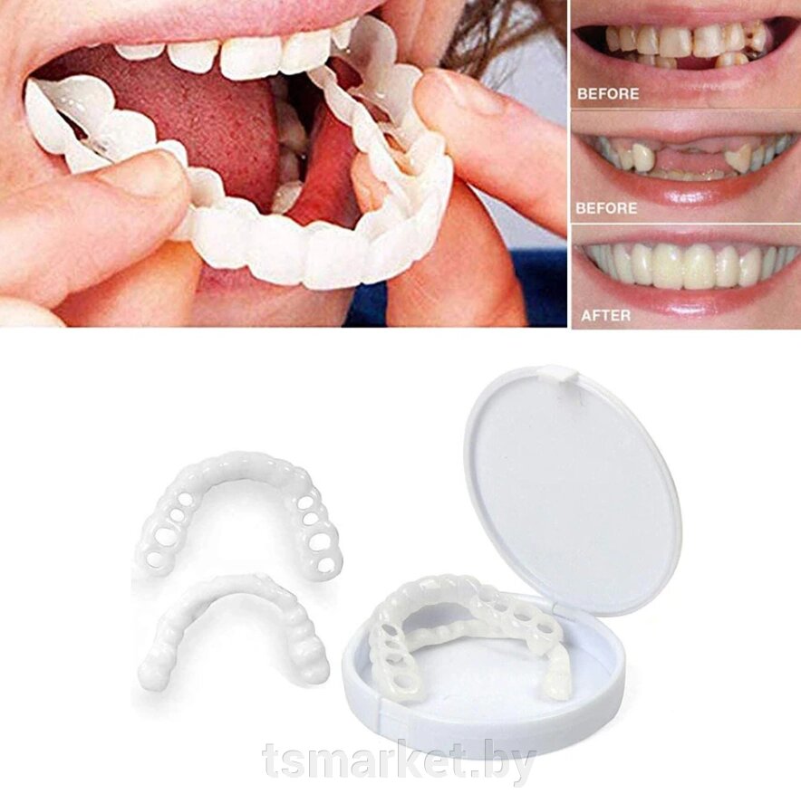 Накладные виниры для зубов Snap-On Smile / Съемные универсальные виниры для ослепительной улыбки 2 шт. от компании TSmarket - фото 1