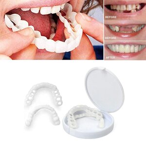 Накладные виниры для зубов Snap-On Smile / Съемные универсальные виниры для ослепительной улыбки 2 шт.