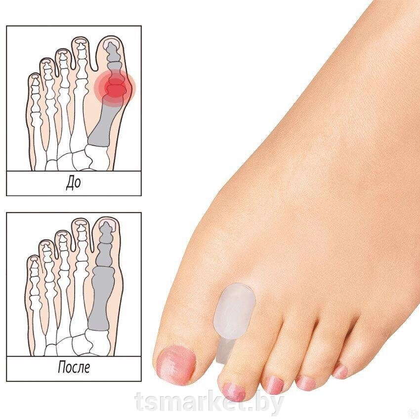 Разделитель для пальцев ног от компании TSmarket - фото 1