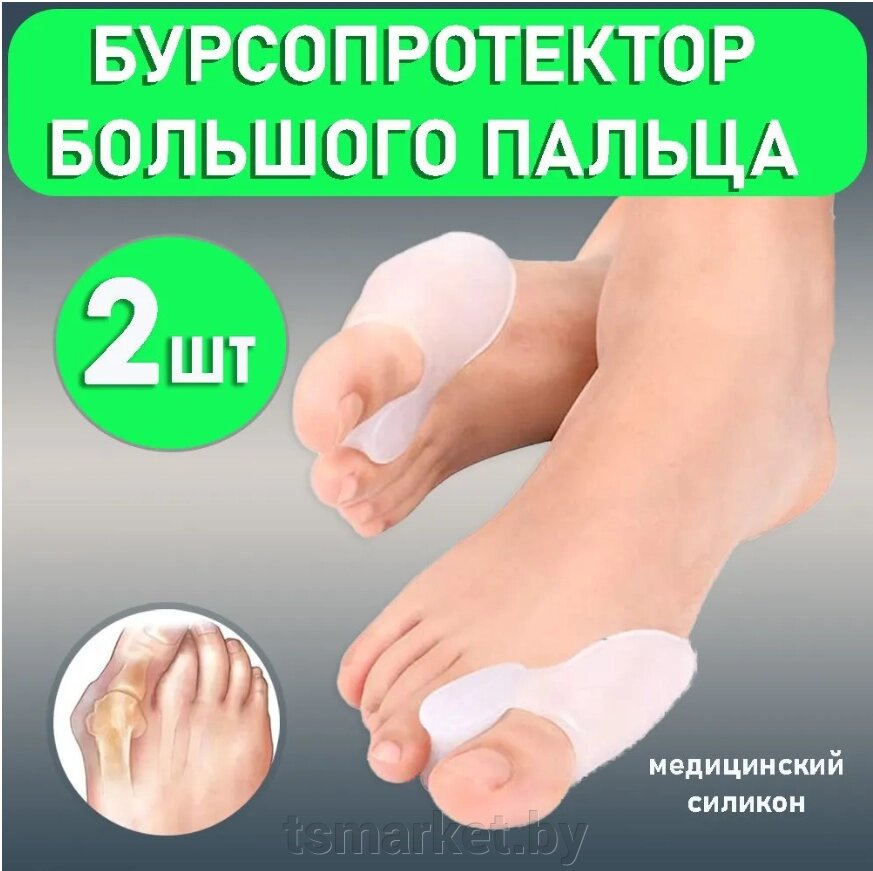 Силиконовый  фиксатор от косточки на ноге Valgus Pro . Фиксатор большого пальца от компании TSmarket - фото 1