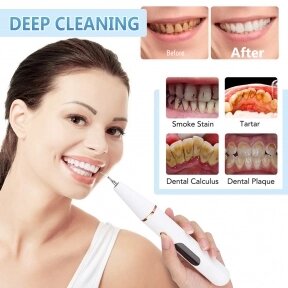 Ультразвуковой портативный скалер Electric Teeth Cleaner with LED Screen для отбеливания зубов и удаления зубного